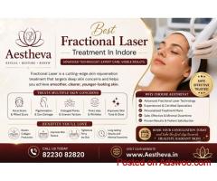 Best Fractional Laser Treatment In Indore