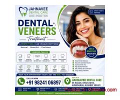 Dental Veneers Treatment in Ahmedabad - DR. Jahanvee
