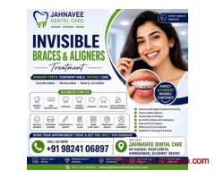 Invisible Braces & Aligners Treatment | Jahanvee Dental Care