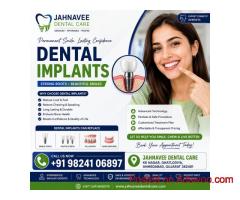 Get Dental Implants in Ahmadabad by Expert Dentists – Jahnavee
