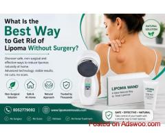What Is the Best Way to Get Rid of Lipoma Without Surgery?