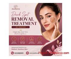Dark Spot Removal Treatment in Indore - Aestheva