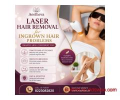 Laser Hair Removal for Ingrown Hair Problems - Aestheva