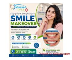 Smile Makeover Treatment – Dental Clinic in Ahmadabad
