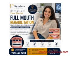 Full Mouth Rehabilitation for Complete Smile - Nuevo