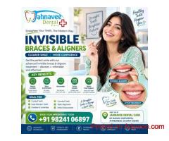 Affordable Invisible Braces & Clear Aligners in Ahmadabad