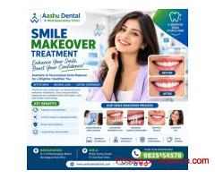 Smile Makeover Treatment Specialists | DR. Manish Shah