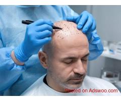 Cara Clinic - Hair Transplant in Mumbai