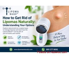 How to Get Rid of Lipomas Naturally: Understanding Your Options