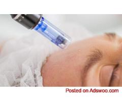 Expert Microneedling Treatment in Reading | Ankita B Dhingra