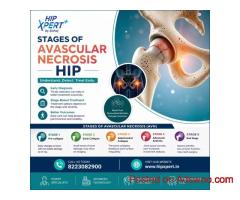 Stages of Avascular Necrosis Hip - HipXpert